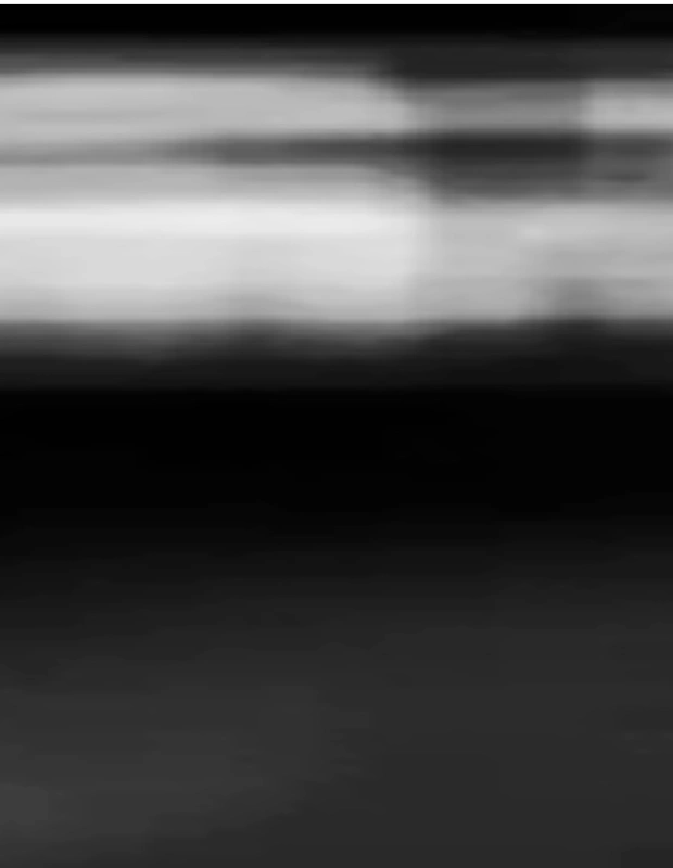 Post hero background seven mobile